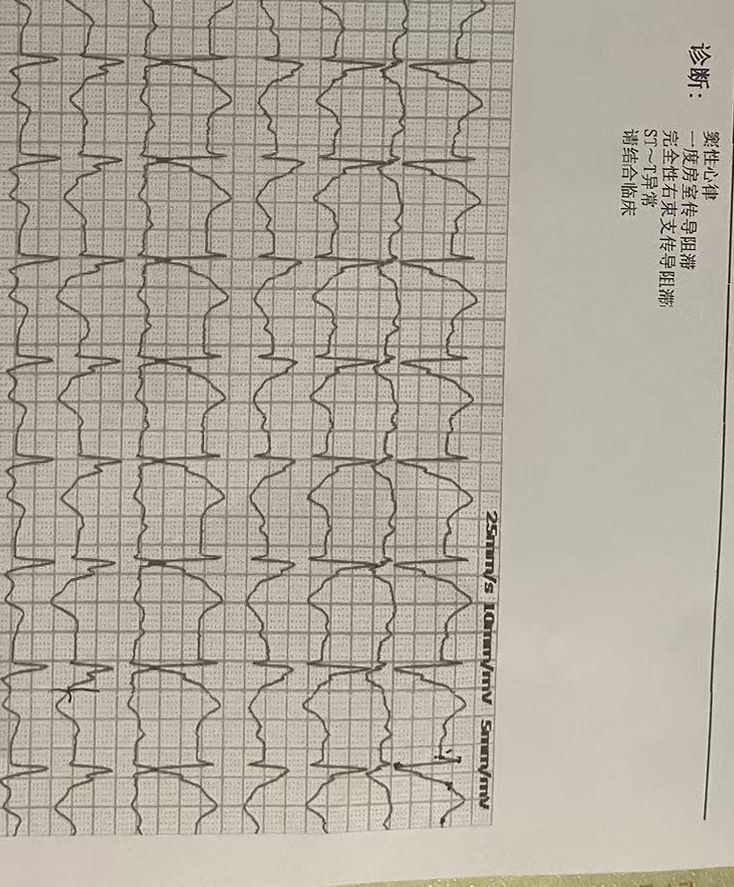 一点小毛病，不严重